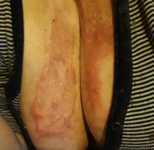Odyleg1